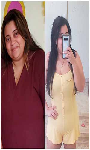 antes-y-despues-gastro-resultados